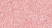 1643655898353.png